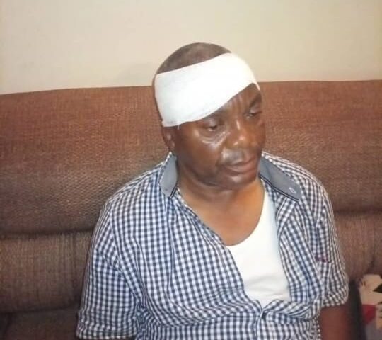 #KIGATO: Sam Ssimbwa Attacked in Kazo, Escapes With Injuries